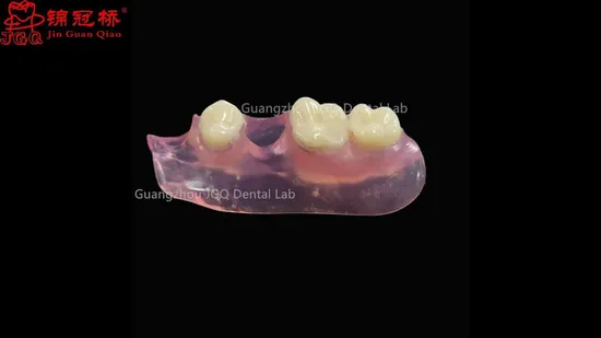 Factory Prices Valplast Flexible Removable Dentures Acrylic Teeth Durable for Maxillary Mandibular Missing Teeth