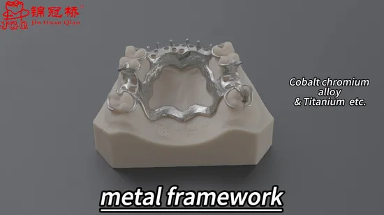 Optimal Comfort Lightweight Yet Strong Removable Partial Dentures Ensure Comfortable Wear Without Causing Fatigue